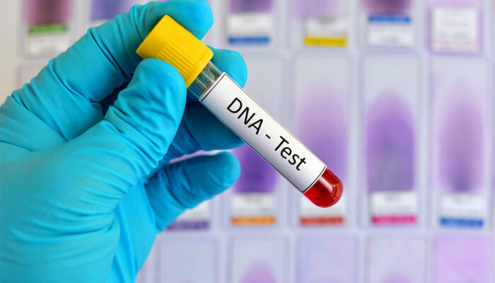 DNA Testing – Definition, Types, and Procedure