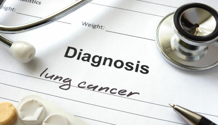 Lung Cancer – Types, Causes, and Symptoms