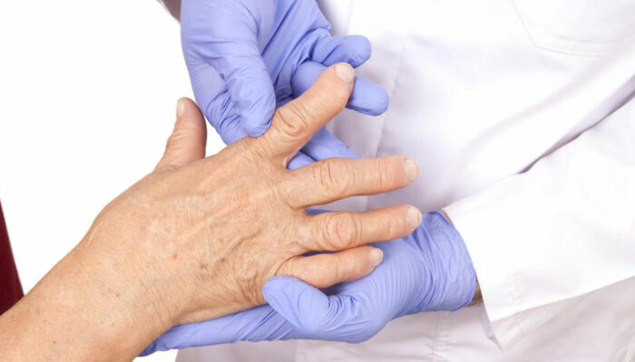 4 best remedies for rheumatoid arthritis