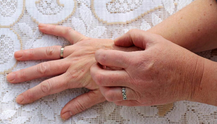 Common causes of skin rash