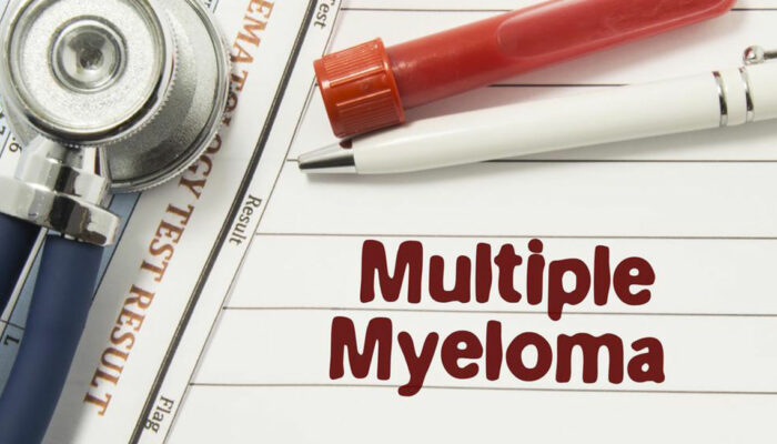 Dealing with multiple myeloma – Things you should know about