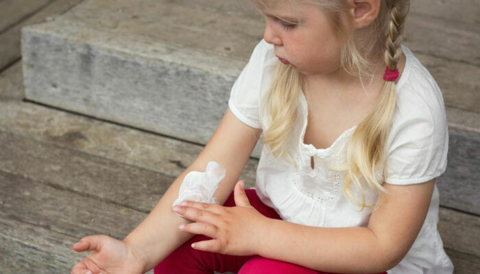 Here’s how you can manage atopic dermatitis