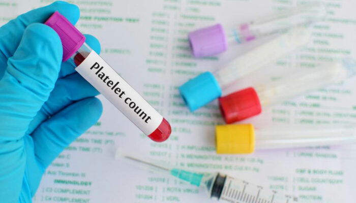 Low platelets count – Its causes and symptoms