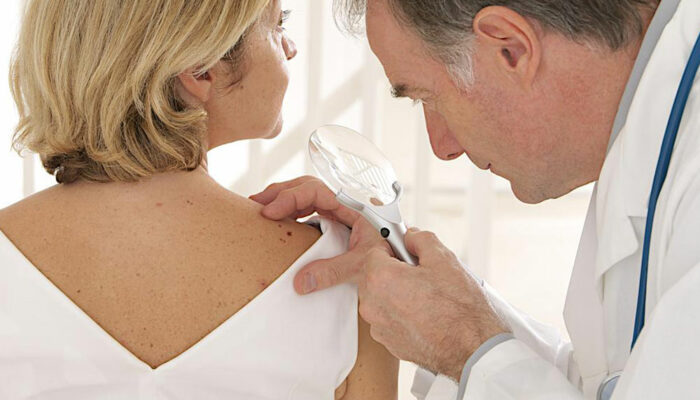 Metastatic malignant melanoma – types of treatment