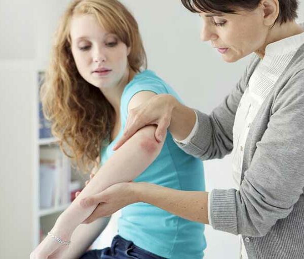 Severe Psoriasis – Treatment Options to Consider