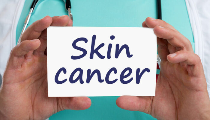 Skin Cancer – Types, Stages, and More
