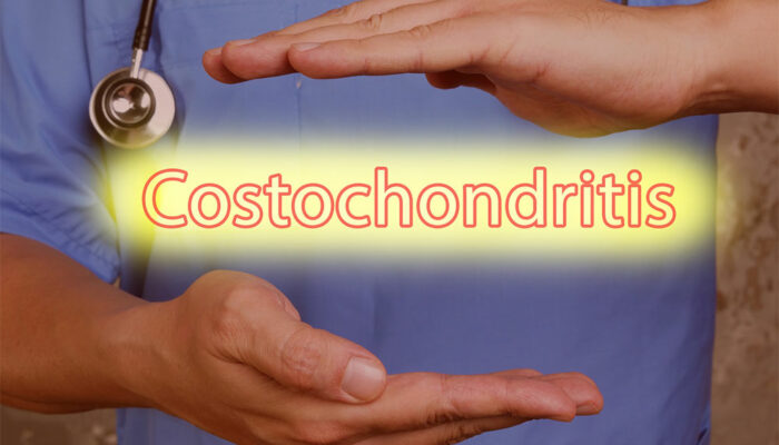 Symptoms, Causes, and Management of Costochondritis