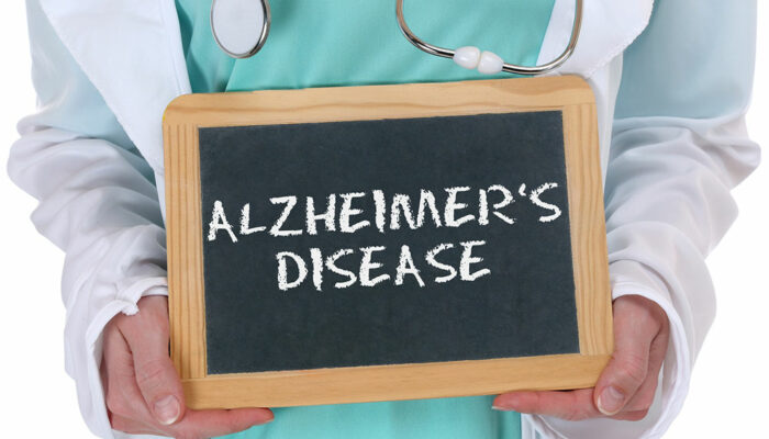 5 things to know about Alzheimer’s disease