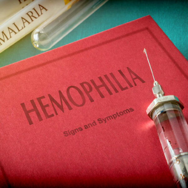 Hemophilia – Symptoms to look out for
