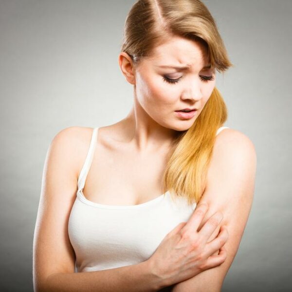 Here’s Everything You Need To Know About Psoriasis