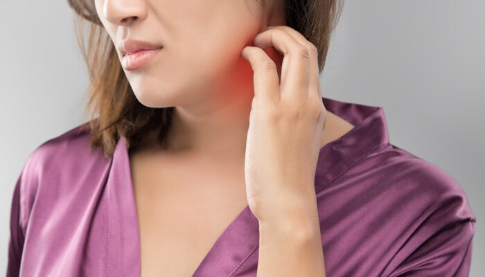 Shingles – Understanding The Condition