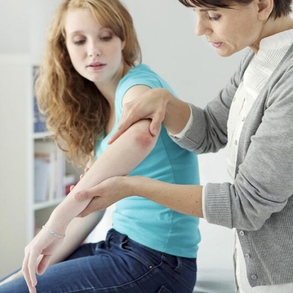 Psoriasis – symptoms, causes, and treatment options