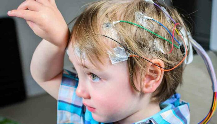 Understanding Important Treatment Guidelines for Seizures