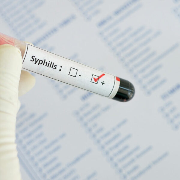 Syphilis – Early Signs and Diagnosis